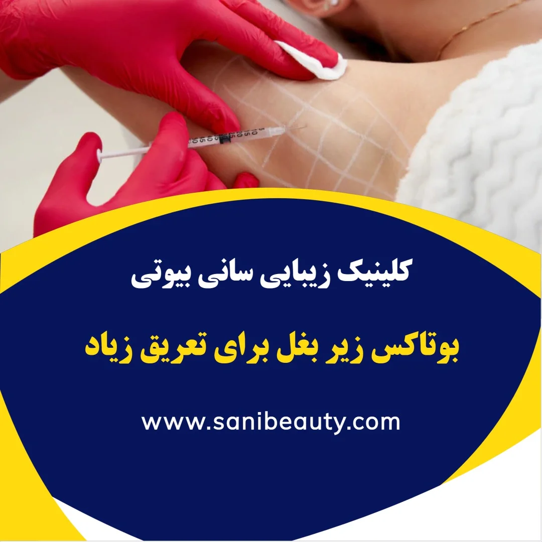 آشنایی با بوتاکس زیر بغل برای کاهش تعریق شدید