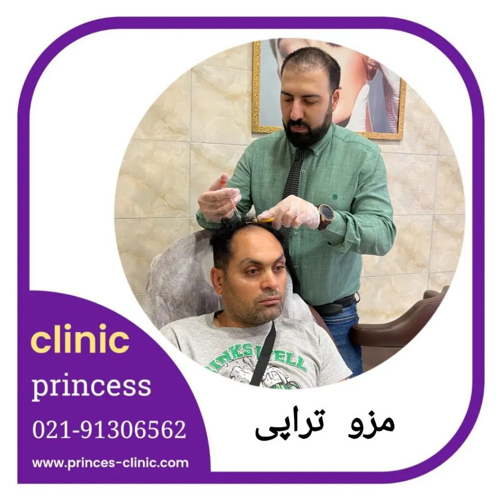 مزوتراپی