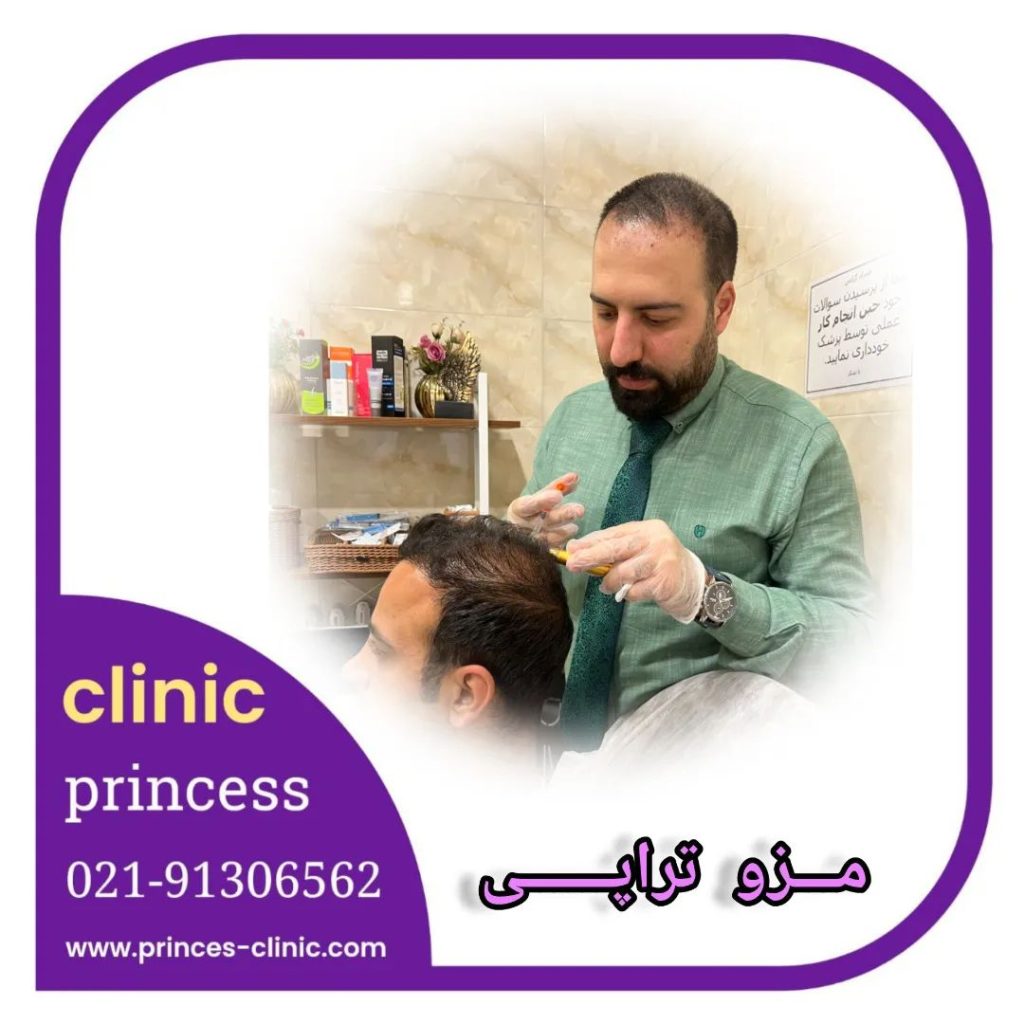مزوتراپی مو
