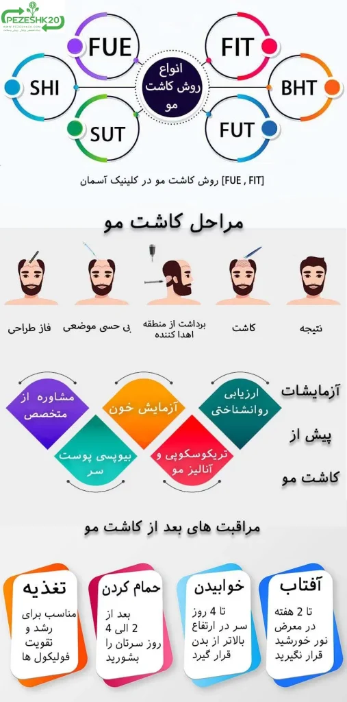 کاشت مو