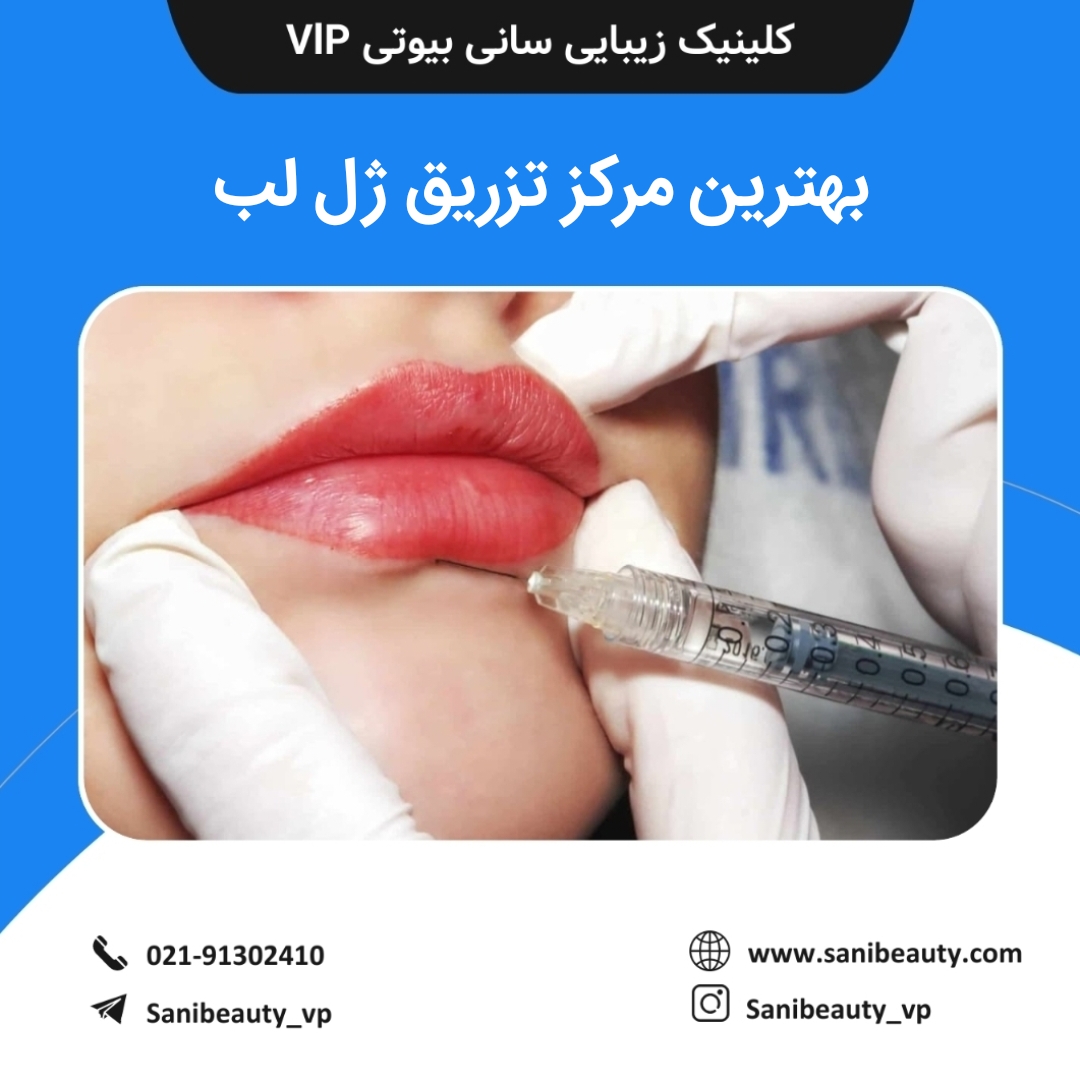 بهترین مرکز تزریق ژل لب