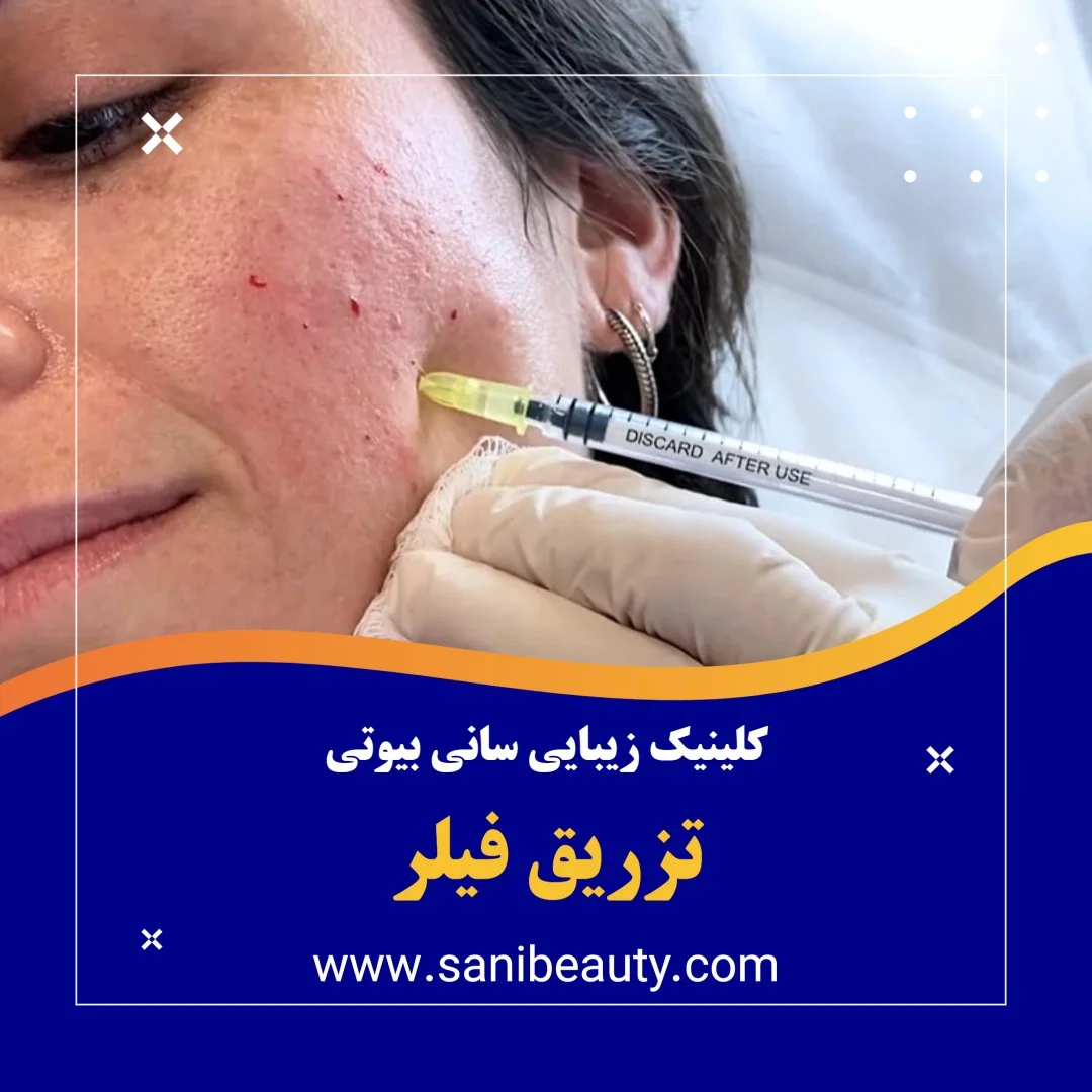 تزریق فیلر