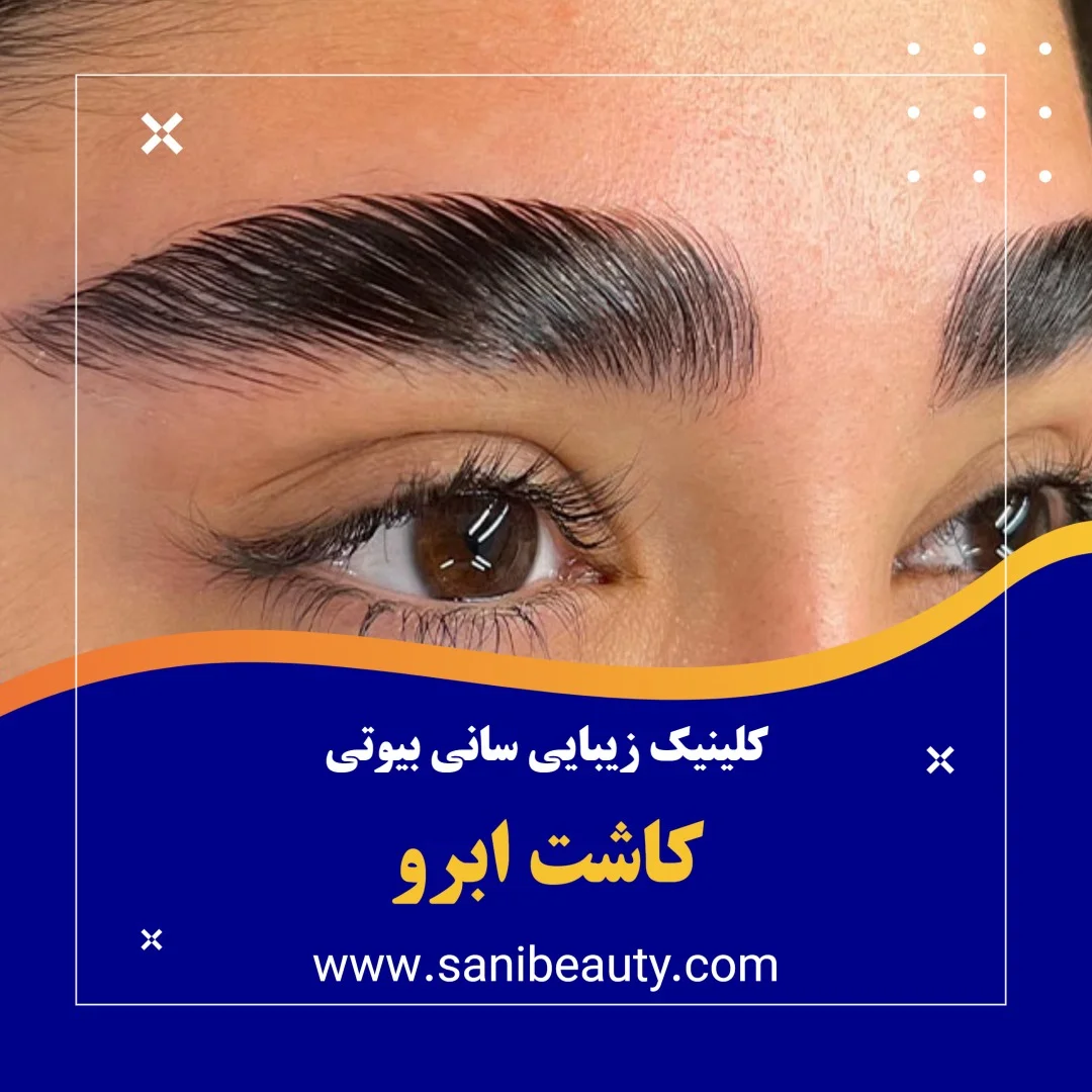 کاشت ابرو