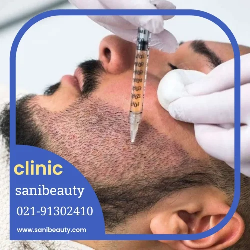 کاشت ریش و سبیل