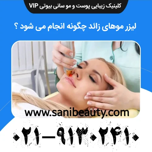 لیزر موهای زائد چگونه انجام می شود